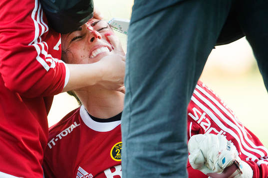 AIKs målvakt Justine Bernier  får sitt ögonbryn