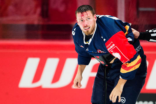 Djurgårdens Mikael Ahlén blöder