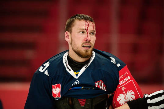 Djurgårdens Mikael Ahlén blöder