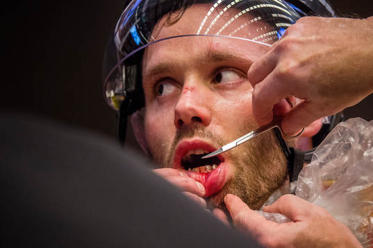 Brynäs Jesper Ollas blir sydd i läppen