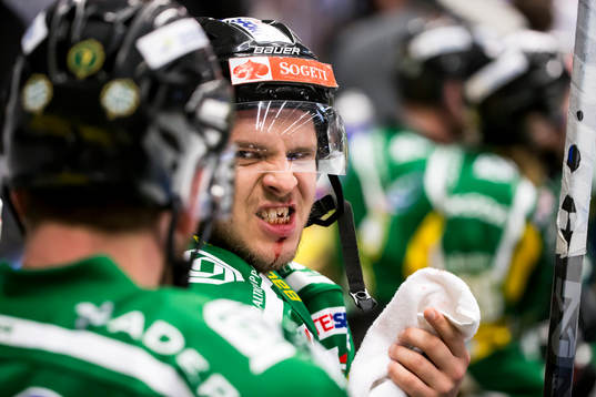Björklövens Lucas Sandström har fått tanden utslagen