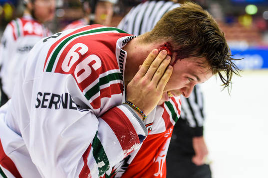 Frölundas Oskar Fantenberg blöder