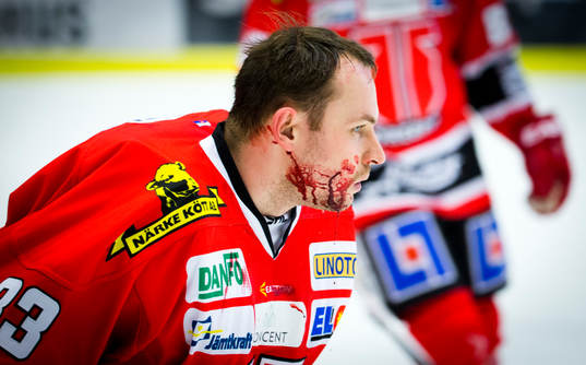 Örebros målvakt Julius Hudacek blöder