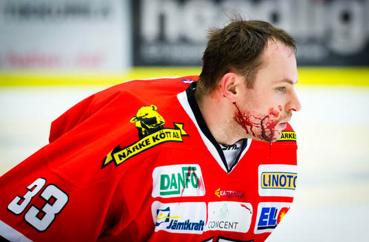 Örebros målvakt Julius Hudacek blöder
