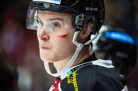 Malmö Redhawks Fredrik Händemark med blod på kinden