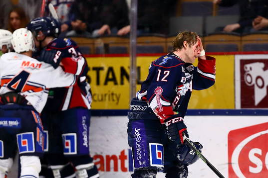 Linköpings Sebastian Karlsson blöder