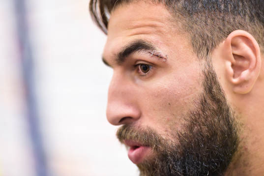 Jimmy Durmaz med häftat sår i ansiktet före Sveriges