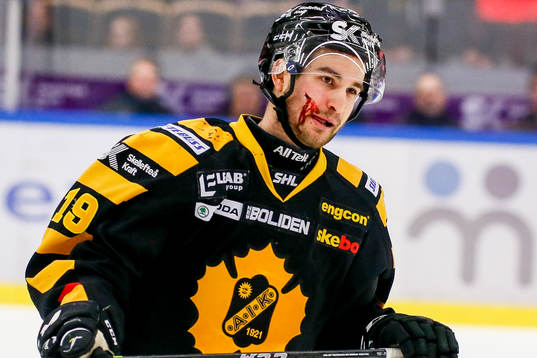 Skellefteås Andrew Calof fick ett skott i ansiktet och var