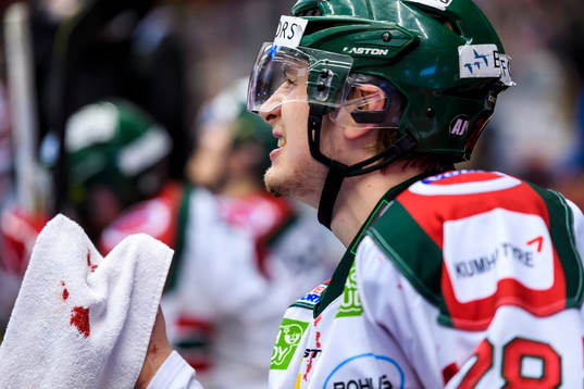 Frölundas Johan Sundström blöder från hakan