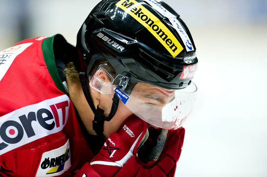 Modos Emil Molin håller sig för ansiktet