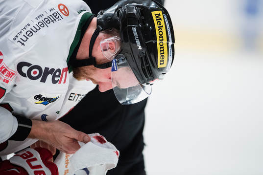 Modos Pär Edblom blöder i ansiktet
