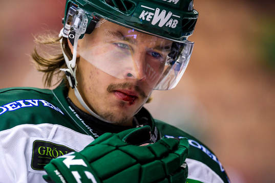 Färjestads Joakim Nygård blöder från munnen