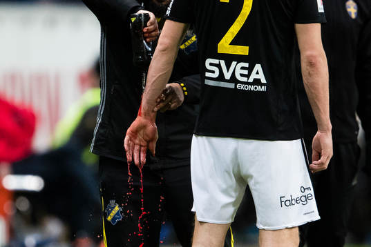 s Haukur Heidar Hauksson blir omplåstrad