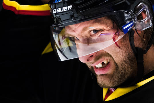 Brynäs Jonathan Granström blöder i ansiktet