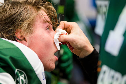 Färjestads Oskar Steen torkar bort blod