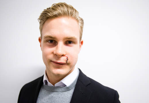 Porträtt på en skadad Bobbo Petersson i Örebro