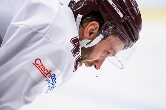 Sparta Prags Michal Barinka blöder näsblod