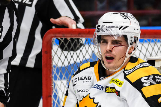 Skellefteås Henrik Hetta blöder