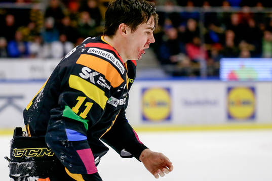 Skellefteås Henrik Hetta fick ett skott i ansiktet och