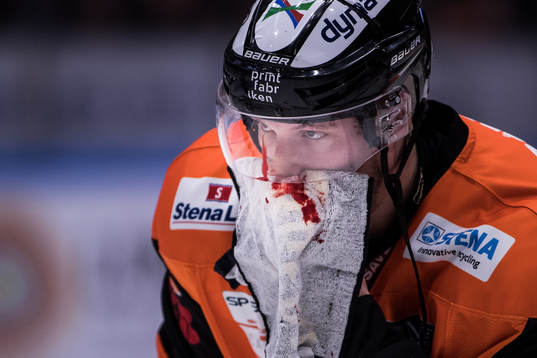 Karlskronas Emil Larsson blöder