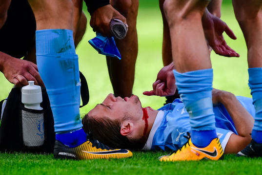 Malmö FFs Pawel Cibicki med skada
