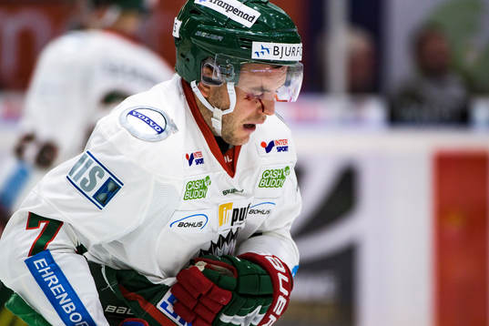 Frölundas Pathrik Westerholm blöder