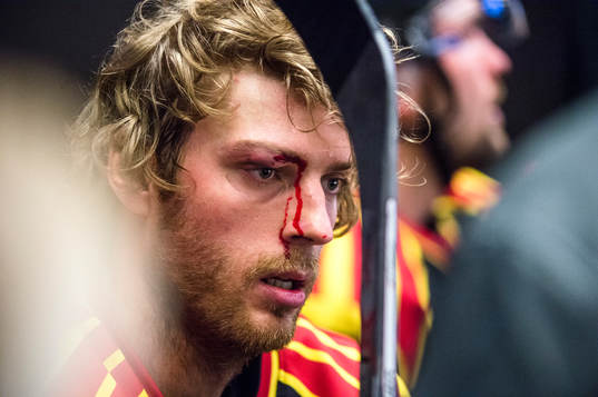 Brynäs Christopher Liljewall med skadat ögonbryn