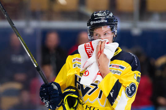 s Victor Ejdsell blöder från ansiktet