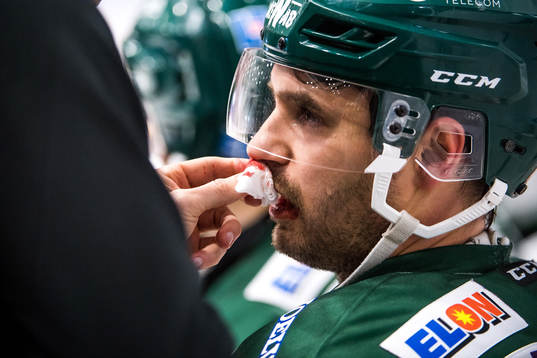 Färjestads Martin Johansson  har ont och blöder