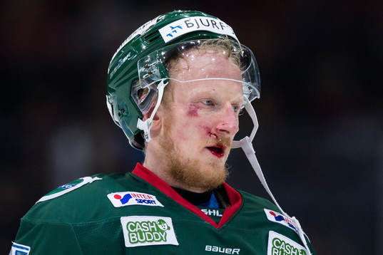 Frölundas Simon Hjalmarsson lämnar isen med skada i