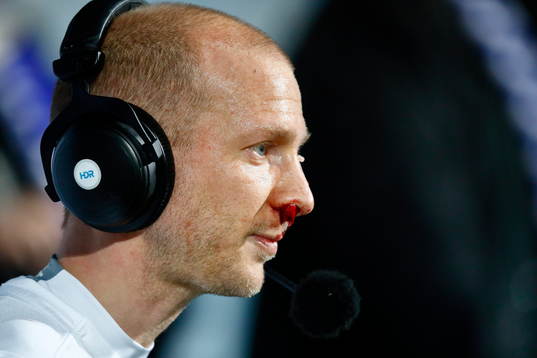 Norrköpings Andreas Johansson med blodig näsa