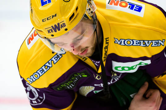 Färjestads Rasmus Asplund har fått en puck i ansiktet och