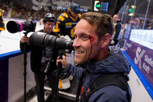 Fotografen Christian Eriksson-Mård blev träffad av puck