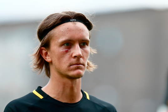 s Kristoffer Olsson deppar med skadad kind