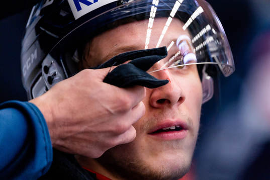 Växjös Jonas Röndbjerg får hjälp med att putsa visiret