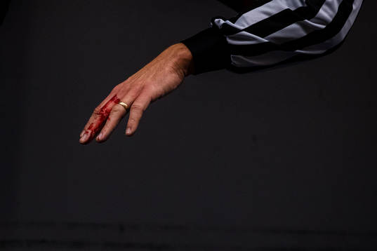 Domare Richard Magnusson med blödande finger