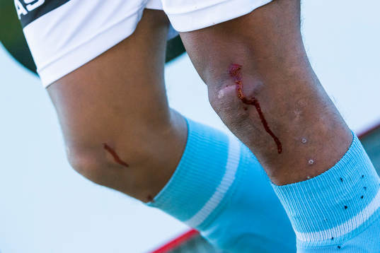 The knee of Erixon Danso of Sandnes Ulf