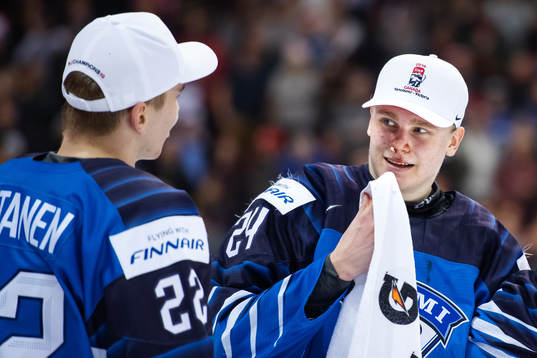 Kaapo Kakko of Finland has a nosebleed