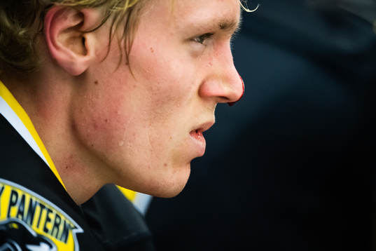 Panterns Albin Johansson skadad med blod rinnande längs