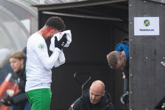 Hammarbys Imad Khalili blöder från huvudet