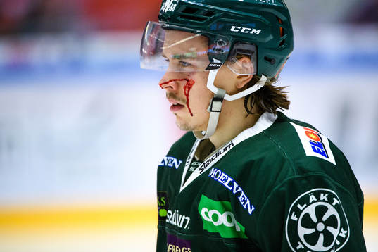 Färjestads Joakim Nygård blöder i ansiktet