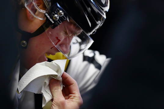 Brynäs Jesper Boqvist blöder från ett sår på kinden