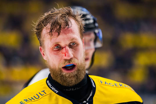 s Martin Thörnberg blöder