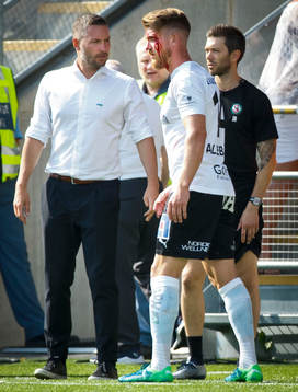 Örebros Michael Almebäck med blod i ansiktet framför