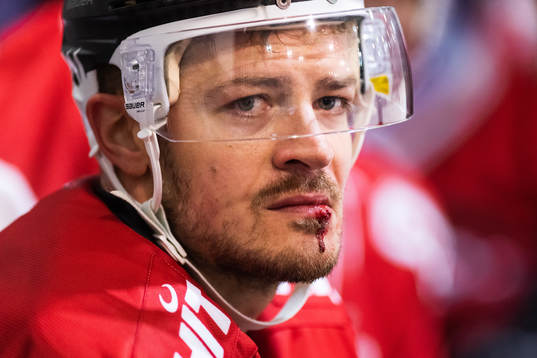 Kölns Moritz Müller med en blödande läpp