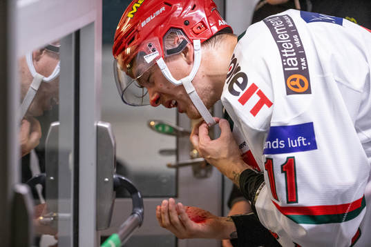 Modos Johan Forsberg blöder