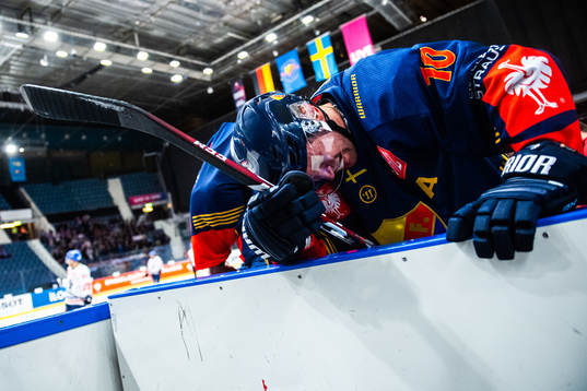 Niclas Bergfors of Djurgården in pain