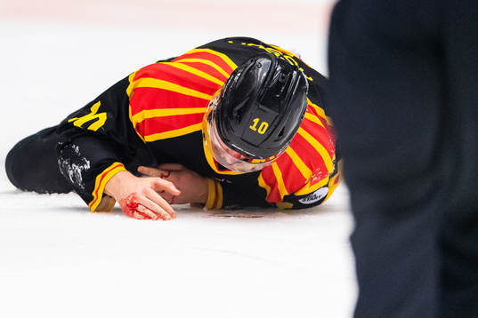 Brynäs Marcus Ersson blöder från ansiktet