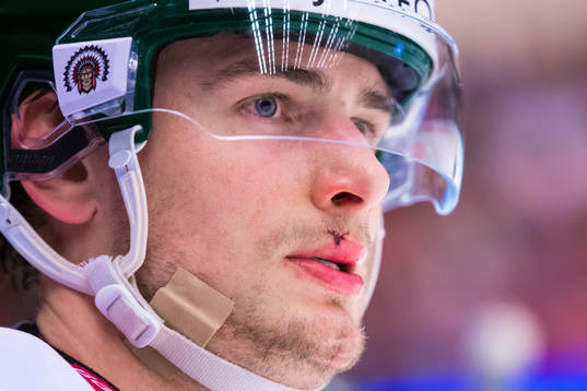 Frölundas Johan Sundström med ett sår på munnen