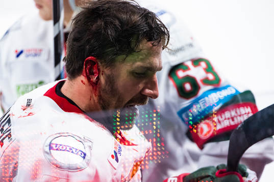 Frölundas Joel Lundqvist blöder från örat